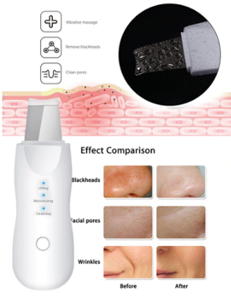Espátula Facial Elétrica para Limpeza de Pele,Peeling,Limpeza Profunda - com Recarga USB (Dispositivo Dermatológico) - BellyShop